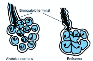 bronquiolo e alvéolos