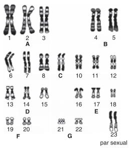 cariótipo humano doenças genéticas e Mutações Cromossômicas