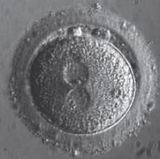 início da fusão de dois núcleos de células reprodutivas humanas