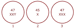 cariótipos de 3 indivíduos da espécie humana com alterações numéricas