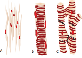 ilustrações dos tipos de fibras musculares